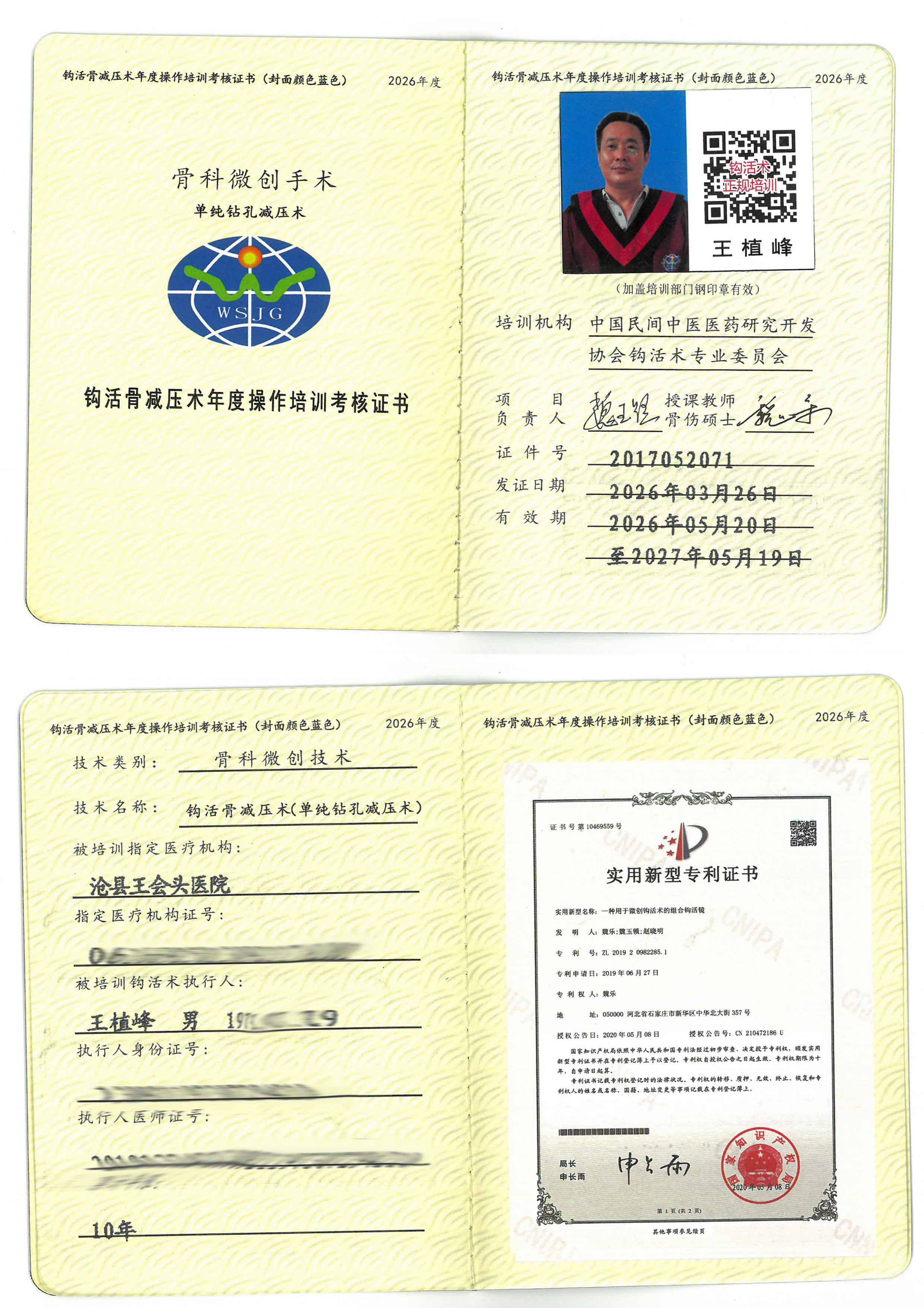 骨减压tm、.jpg
