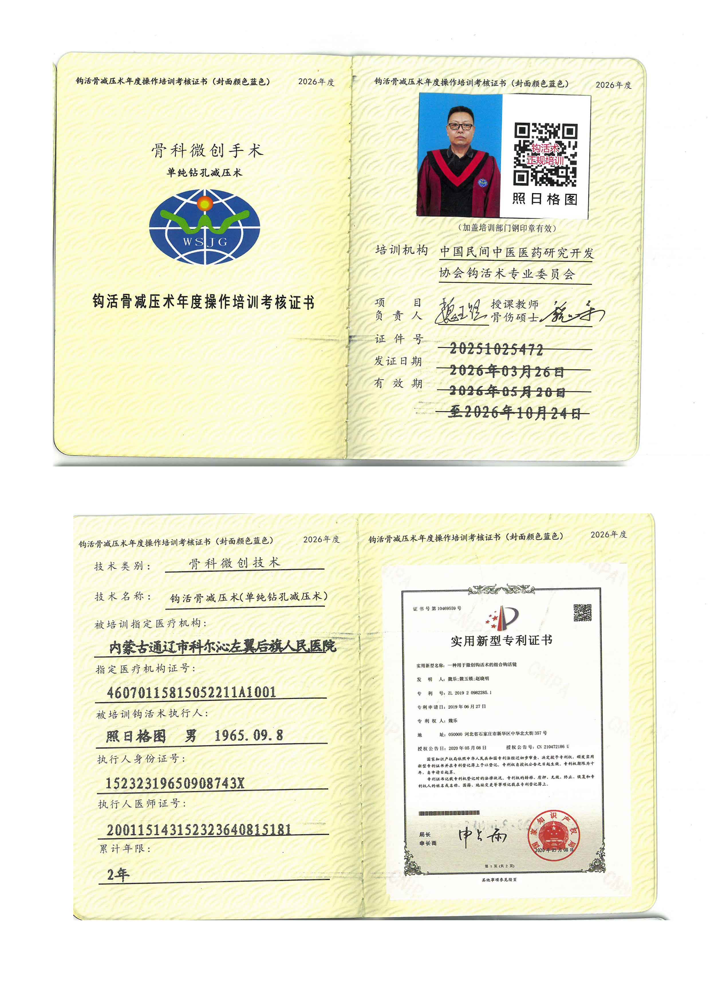 骨减压tm.jpg